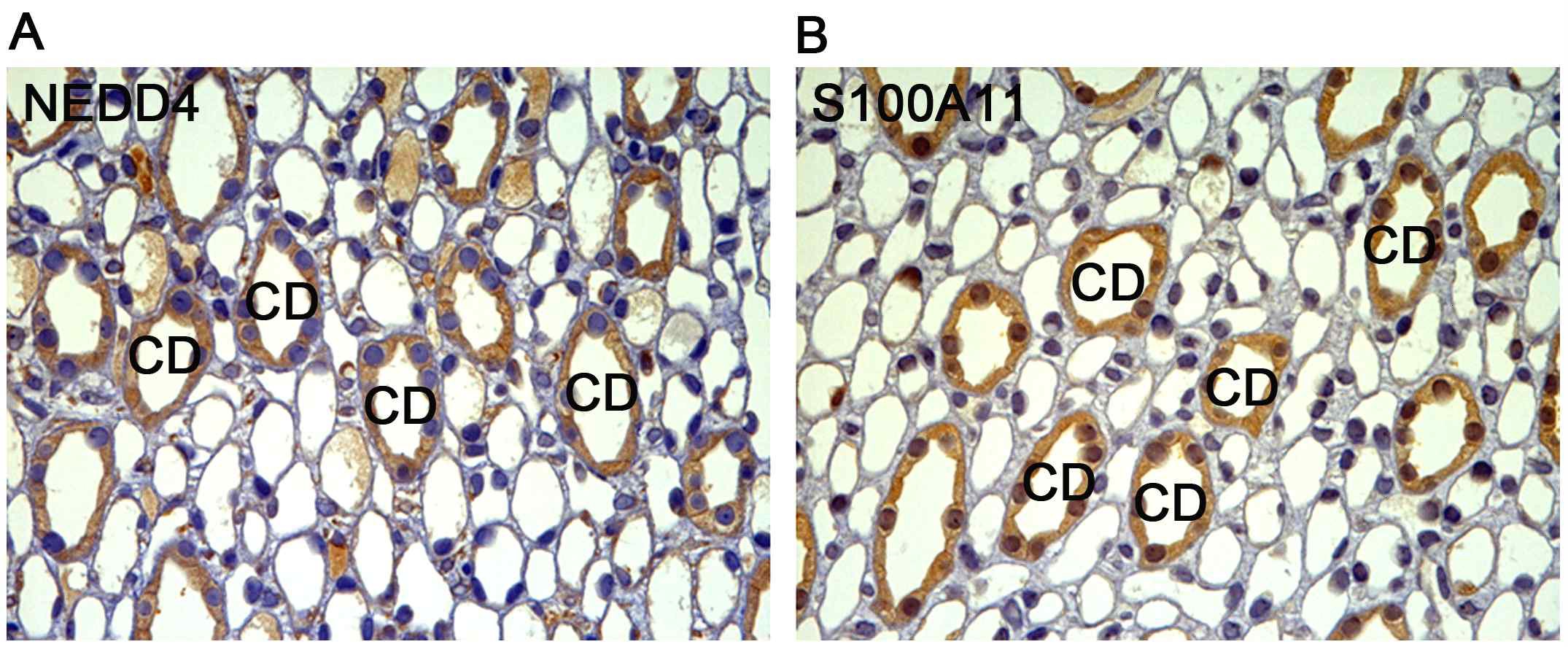 그림. NEDD4 기질 후보 단백질 중 S100A11을 우선 선정하여 면역 염색법을 시행한 결과, S100A11 은 신장 속수질 집합관에서 발현됨을 확인함.