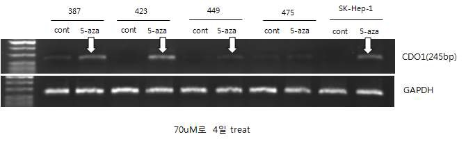 Figure 1. CDO1 gene expression. In HCC cell lines, CDO1 gene expression is enhanced (white arrows) after demethylation treatment (5-Aza-dC treatment) compared to control cell lines (RT-PCR). We selected the SNU-387 and SNU-423 cell lines for further experiment.