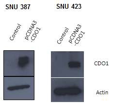 Figure 2. Western blot. CDO1 protein is hyperexpressed after si RNA treatment