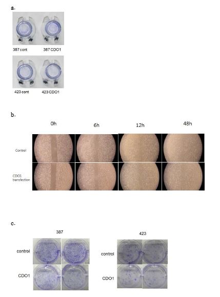 Figure 4. There is no differences between control and CDO1-overexpressed cells in invasion assay (a), migration assay (b), or colony-forming assay (c)