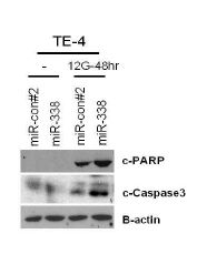 그림 9 Radiation treatment후 apoptosis molecule의 변화