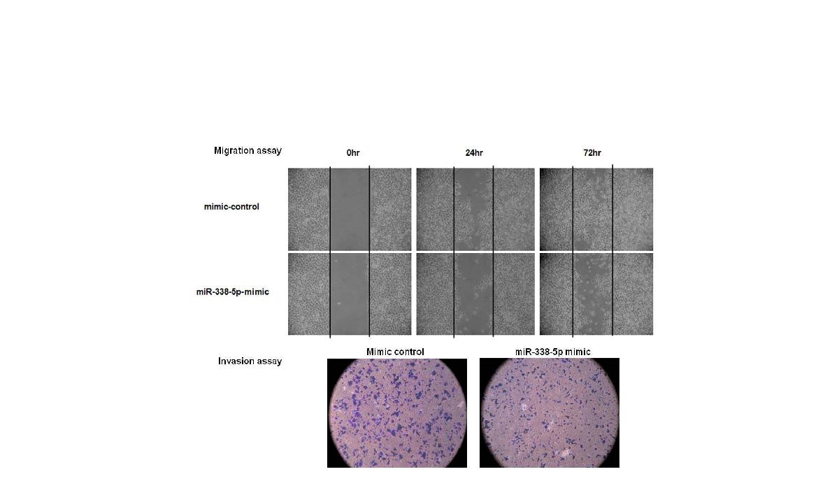 그림 11 miR-338-5p에 의한 cell migration과 invasion의 변화