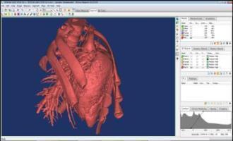 Mimics로 변환된 돼지 심장 3D 이미지