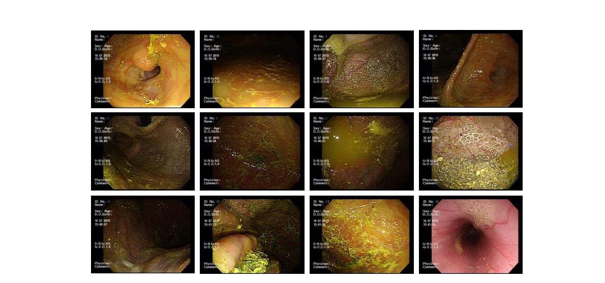 Gastric distribution of the S-Clarithromycin (S-CLR) in No.3 mini pig.