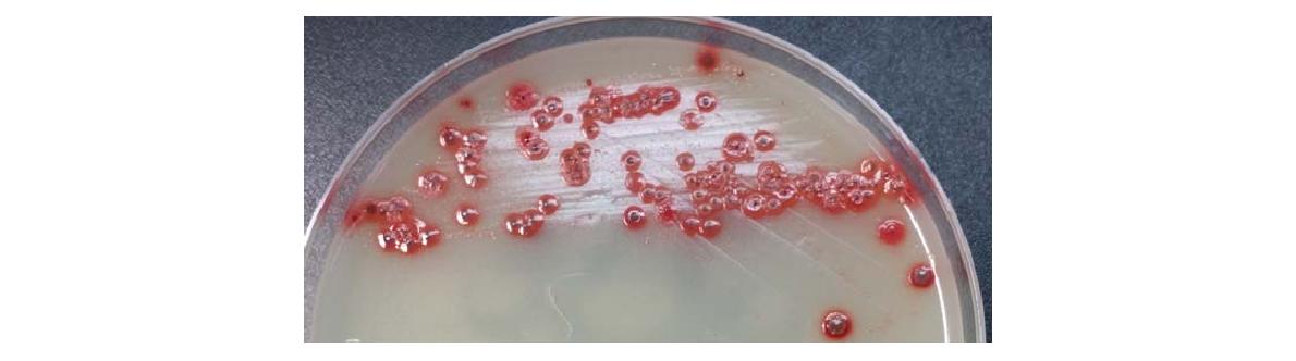 The standard strain (ATCC 43504) of H. pylori. in EYE agar plate. H. pylori was well cultured as red-colored colonies.