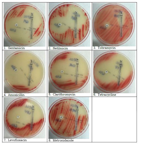 Disc diffusion test and E-test against standard strain of H. pylori. This strain had a resistance to metronidazole and higher MIC to tobramycin than to other aminoglycosides.