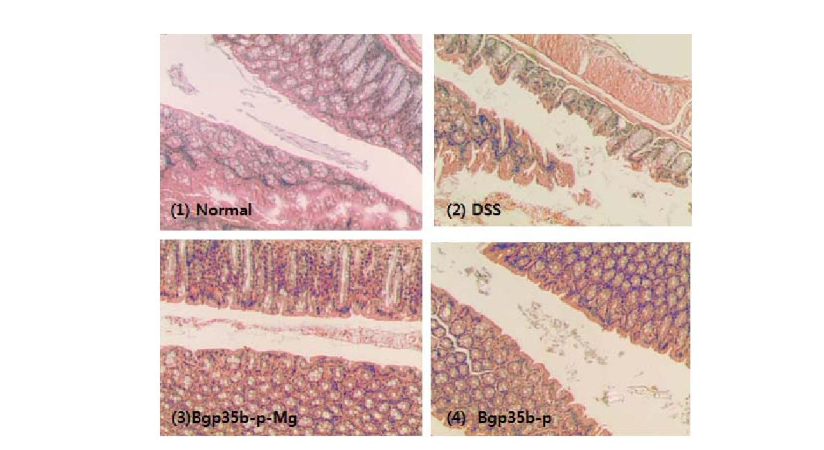 IBD(염증성 장질환) 동물모델에서 점토광물의 경구 섭취에 따른 결장조직의 변화 (H&E 염색, 100X)