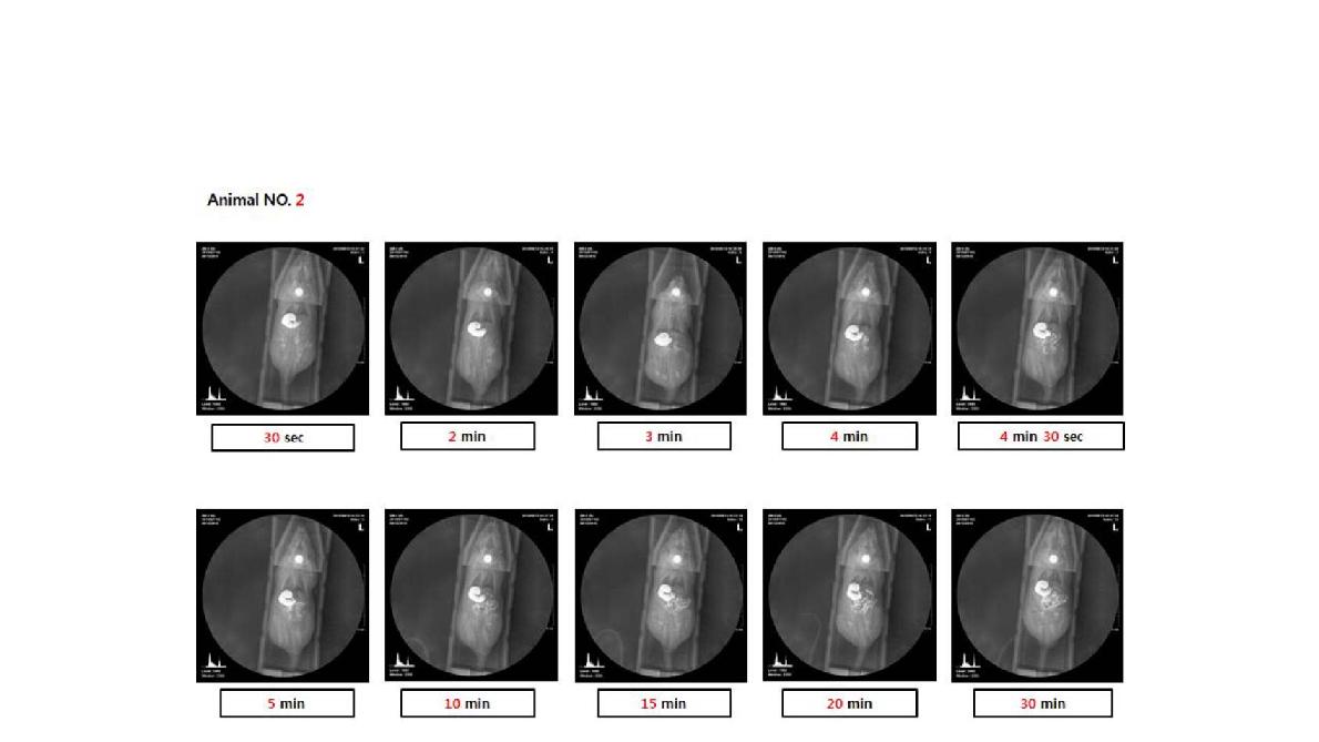 S-Barium 경구 투여 후 시간대별 X-ray 촬영 결과