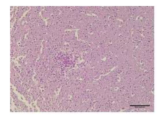 Fig. 12. 뇌실질의 단핵구 침윤