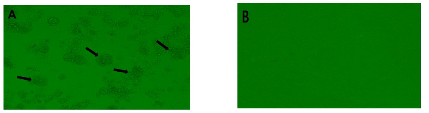 Figure 1. Cytopathic effects induced by NDV live vaccine at 3 dpi in CEK cells.