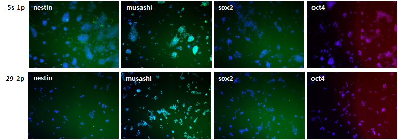 Immunocytochemical characterization of selected 5s and 29 line cells. Marker proteins of NPCs (nestin, musashi) and undifferentiated cells (oct4 and sox2) were counter-stained with Hoechst (nucleus marker).