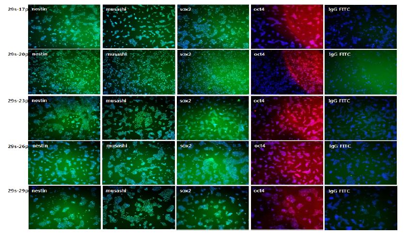 Immunocytochemical characterization of 3rd passage NPC (29). Marker proteins of NPCs (nestin and musashi) and undifferentiated cell (oct4 and sox2) were counter-stained with Hoechst (nucleus marker)