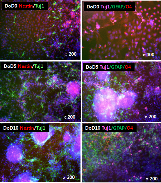 Immunocytochemical characterization of differentiated cells at 5, 10 days after differentiation (NS method)