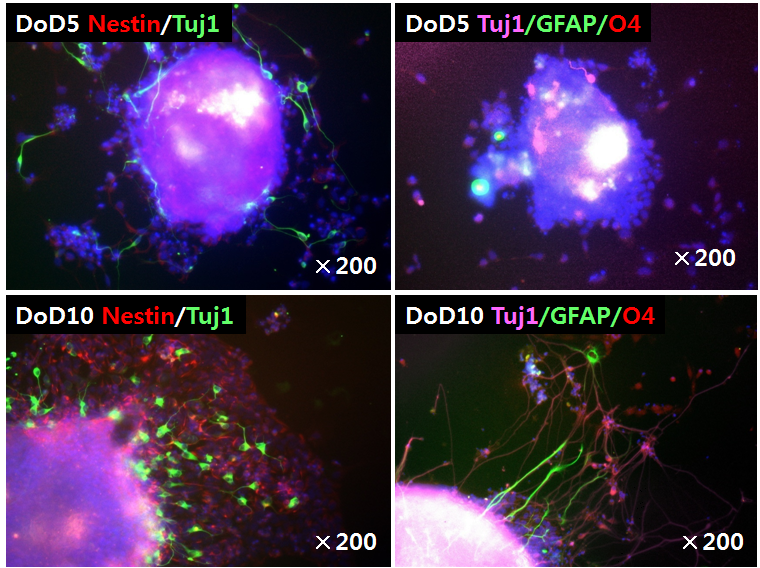 Immunocytochemical characterization of differentiated cells at 5, 10 days after differentiation (SP method)