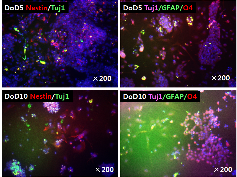 Immunocytochemical characterization of differentiated cells at 5, 10 days after differentiation (SC method)