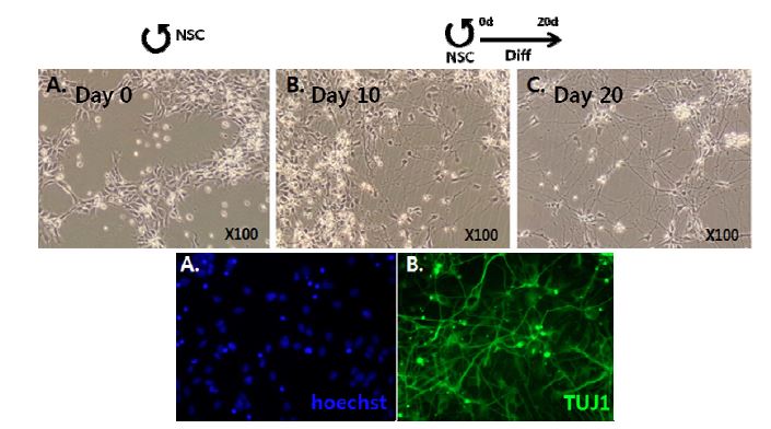 Differentiation of hNSC (Gibco) into neurons for 20 days in differentiation medium. At 20 days of differentation, neurite was prominently developed.