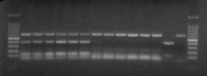 Direct PCR results of DNA of wild boar W-1711 (lane 1 ~ 9) and W-1712 (lane 10 ~ 12). MTB detection kit for PCR was used and lymph node samples of W-1711 (lane 1 ~ 6) showed positive results (HLN, hilum lymph node; LLN, laryngopharyngeal lymph node). Lung1 of W-1711 (lane 7 ~ 9) and lung2 of W-1712 (lane 10 ~ 12) showed negative results. The experiment was performed in triplicate. +, M. bovis positive control; －, negative control; M, 100 bp marker