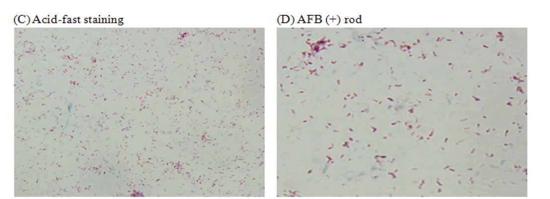 Fig. 5. Staining of fecal samples by Acid-fast staining and AFB (+) rod. (x1000)