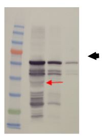 그림 1. PRRSV NNA epitope cluster 단백질의 대장균내 발현확인