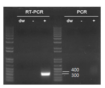 그림. hTERT virus 발현을 유도시킨 후, 상층액에서 RNA를 얻고 RTPCR을 수행한 결과 hTERT virus가 존재하는 것을 확인. ( - ): 세 개의 plasmids로 transfection 하지 않은 세포 (+): 세 개의 plasmids로 transfection 한 세포