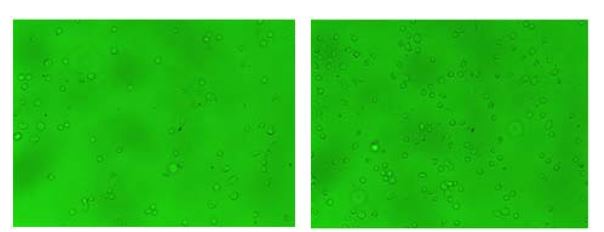 그림. 돼지 PBMC에서 adherent cell(A)과 non-adherent cell(B) 분리