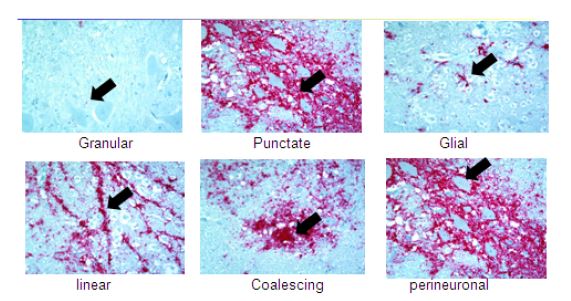 그림 1. 면역조직화학염색법(IHC)상 immunolabelling pattern