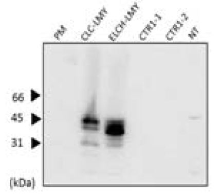 Expression test of ELCH/CLC LMY in Arabidopsis protoplasts