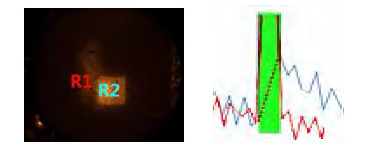 Ca2+image of neurons of Ad-CMV-CatCh(L132C)-EYFP and R-GECO DNA plasmid transfected mouse brain using patterned light stimulation (R1,R2:Range of interest1,2, R1: Unstimulated neuron, R2: Stimulated neuron)