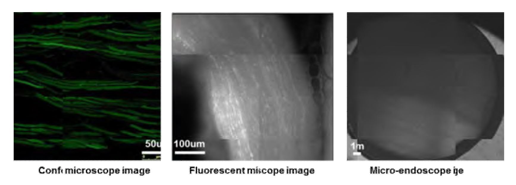 ChR2-GFP 발현된 좌골신경의 형광영상. 공초점 현미경(좌), 일반 형광현미경(중), 광섬유 내시경 시스템(우)