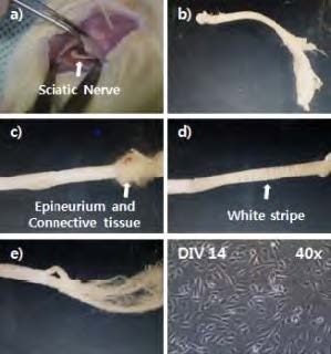 Sciatic nerve 적출과정