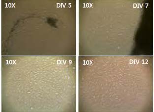 Schwann cell culture