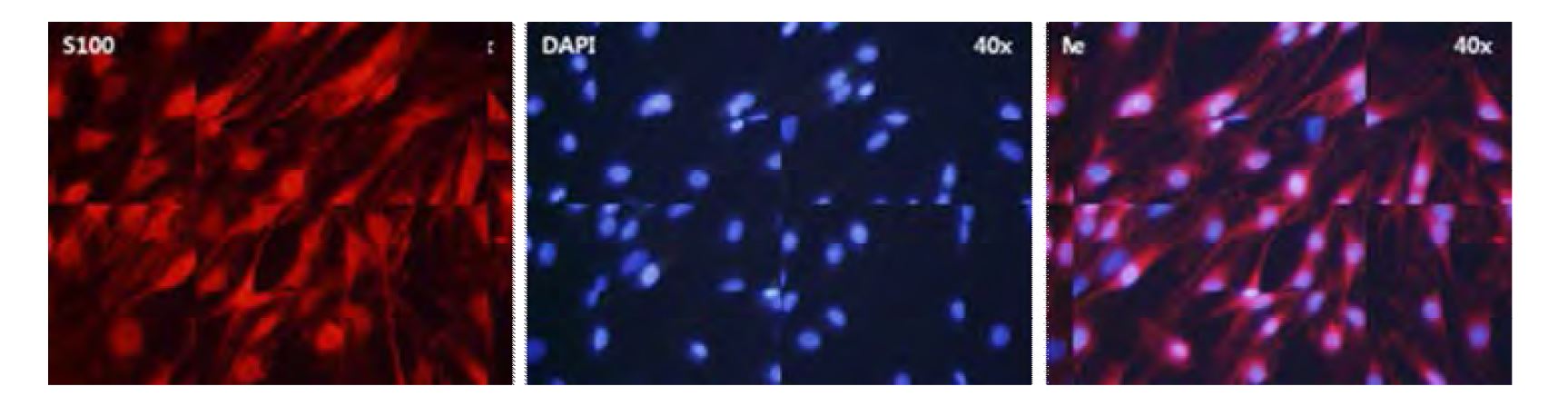 Immunostaining of Schwann cells