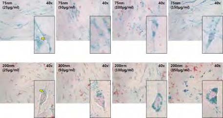 Prussian blue & nuclear fast red staining (75, 200nm size 자성나노입자 결과)