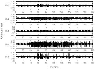 Recorded signal (region 1)