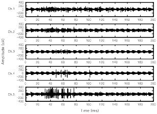 Recorded signal (region 3)