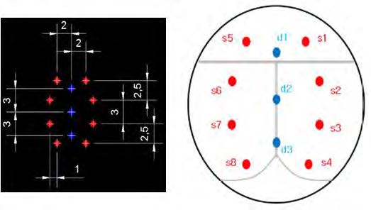 Rat의 brain : 오른발에 전기자극을 주었을 때 일어나는 functional activity를 측정