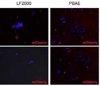 시각세포(retinal ganglion cell) 내로 PBAE 고분자 나노파티클을 이용한 ChR2 유전자 이입 분석