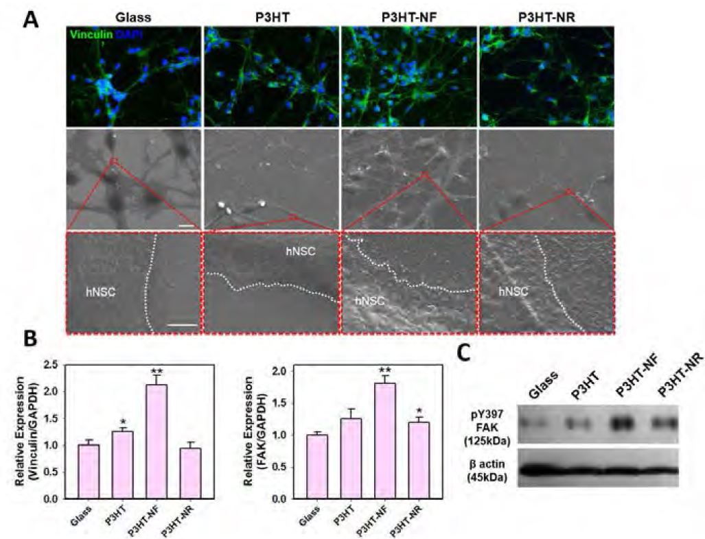 p3HT 기판 상에 배양된 신경줄기세포의 초점접착력 발현 및 부착 형태 분석