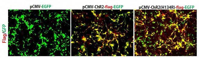 ChR2와 ChR2(H134R) 형태가 레트로바이러스에서 제대로 된 기능을 하고 있는지 면역형 광염색볍을 통해 관찰하였음