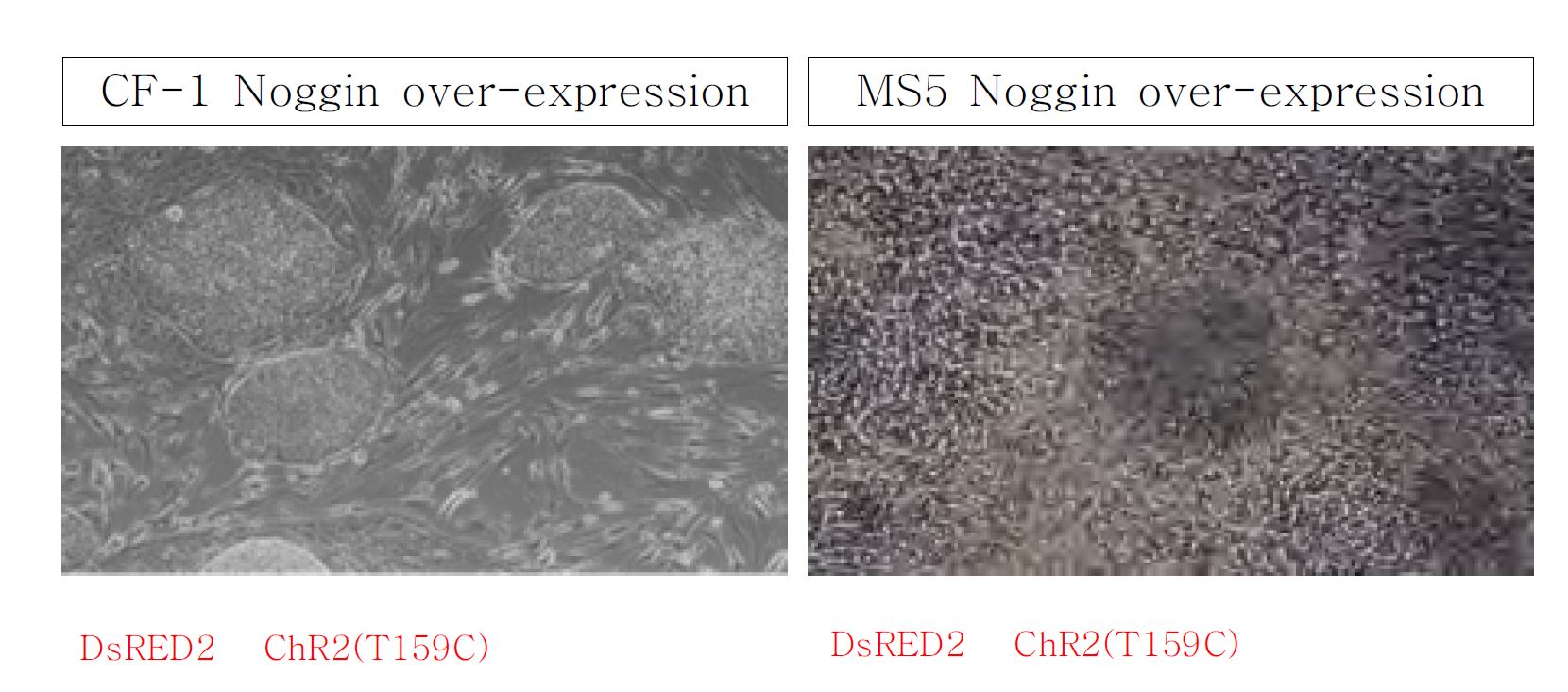 각각의 CF-1과 MS5 feeder에 noggin gene을 over-expression한 상태에서 ChR2-expressing hiPS cell colony를 올려 분화를 진행하였음. MS5에 올려진 상태에서 Dx를 넣어 ChR2의 발현을 인위적으로 억제할 수 있을 뿐만 아니라 뚜렷한 분화양상을 보여주었음