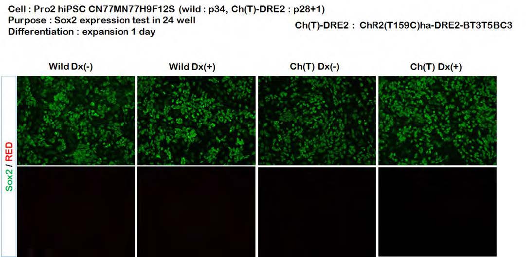 Neural precursor의 expansion상태에서 proliferation marker인 SOX2를 관찰하였음