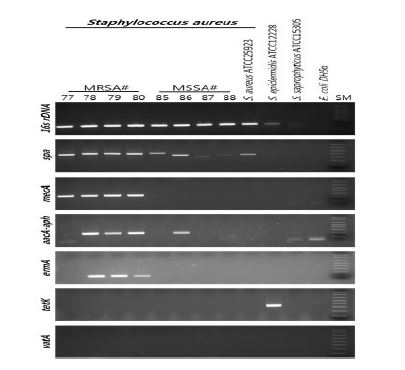 그림 43. 항생제 내성 관련 유전자 확인