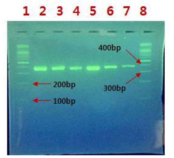 그림 3-8-11 겔-전기 영동기술을 통해 광열효과로 인해 추출된 대장균 O157:H7의 특정 핵산 (eaeA gene) 의 증폭 여부 검증과 결과를 확인