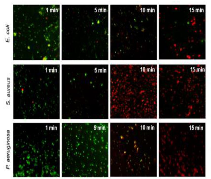 그림 3-9-3 E. coli, S. aureus 그리고 P. aeruginosa 의 레이저 조사 시간에 따른 형광사진