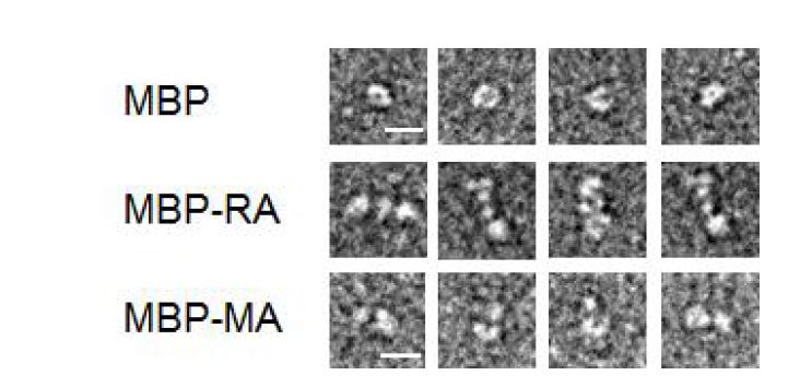 MBP-모노아비딘 fusion 단백질 TEM 분석