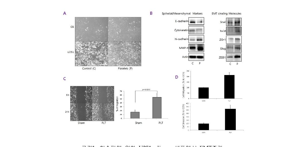 그림1. 혈소판에 의한 U251 glioma 세포에서 EMT증가