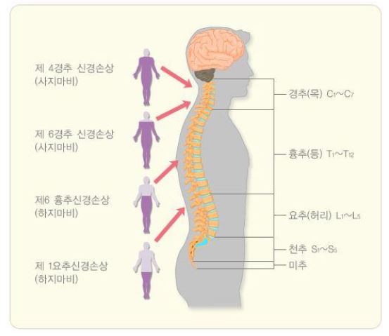 그림 211. 척수손상 위치에 따른 마비부위