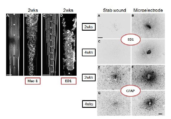[그림 7] 미세전극 삽입 후 신경아교세포들이 전극을 감싼 모습(좌), 미세전극 삽입 후 조직변화가 지속되는 모습(우)