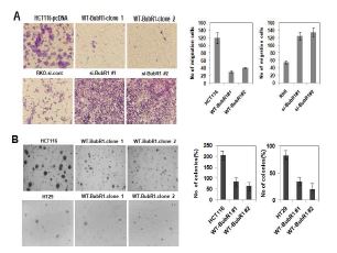 [그림4] 대장암세포주에서 BubR1 단백질 발현에 따른 종양악성화 분석