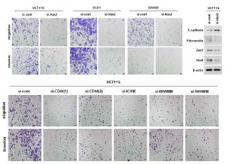 [그림4] HAS-HA-CD44 신호기전이 대장암 세포주의 종양악성화 관련성 분석